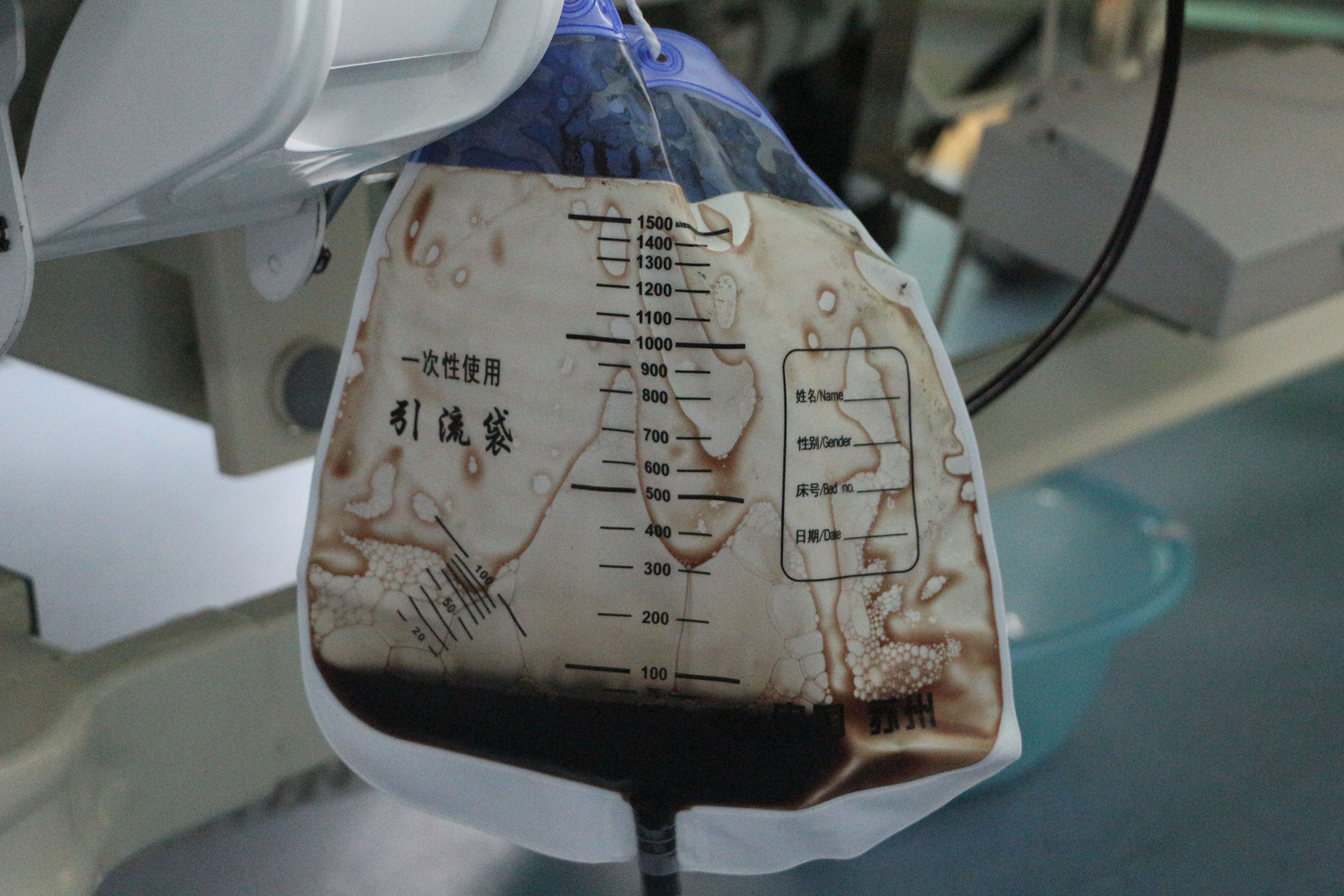 一周内多起胡蜂蜇伤事件 县中医院争分夺秒抢救患者