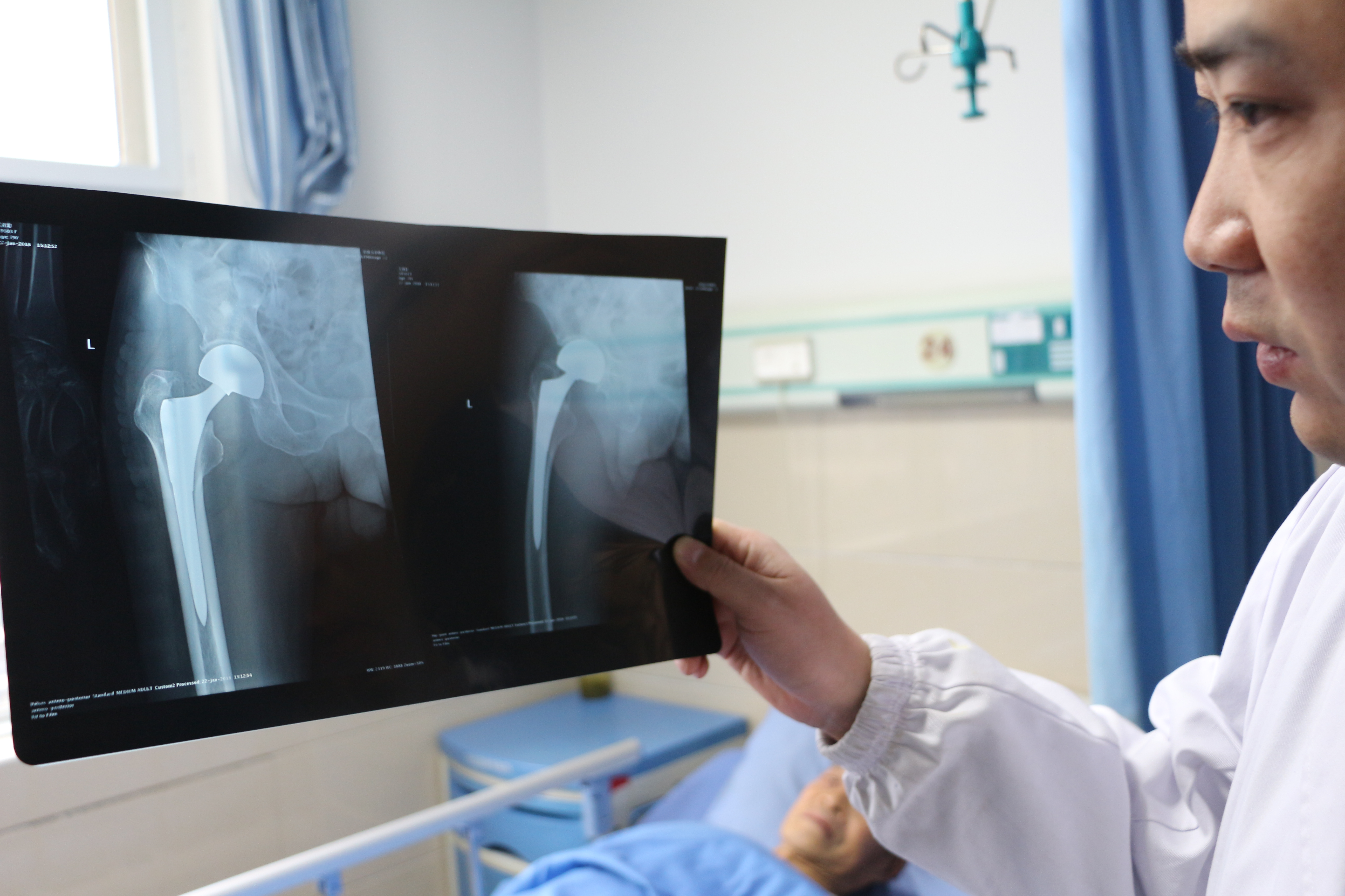 迈开新生的第一步 吴大爷开心的笑了