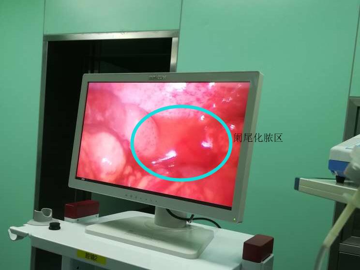 腹部疼痛难忍，喝酒能缓解症状？医生说：NO