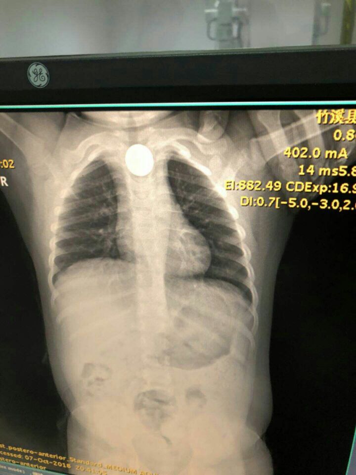 都是硬币惹的祸